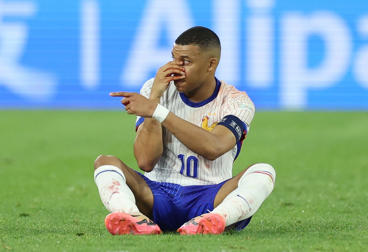 Kylian Mbappé's injury: Mask for remainder of Euro 2024, doubts for Netherlands clash